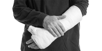man with broken arm in a cast